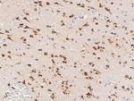 Neuroserpin Monoclonal Antibody (08)