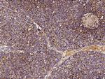 SOD2 Recombinant Rabbit Monoclonal Antibody (012)