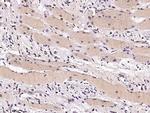 STUB1 Recombinant Rabbit Monoclonal Antibody (006)