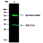 SULT1A1 Antibody in Immunoprecipitation (IP)