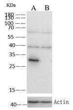 SULT1A1 Monoclonal Antibody (3C5H6)
