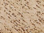 SULT1A1 Antibody in Immunohistochemistry (Paraffin) (IHC (P))