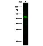 SULT2B1 Recombinant Rabbit Monoclonal Antibody (007)