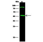 CD254 (RANK Ligand) Recombinant Rabbit Monoclonal Antibody (218)