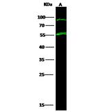 TPH1 Antibody in Western Blot (WB)