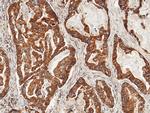 ULBP2 Antibody in Immunohistochemistry (Paraffin) (IHC (P))