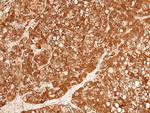 ULBP2 Antibody in Immunohistochemistry (Paraffin) (IHC (P))
