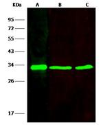 VAPB Recombinant Rabbit Monoclonal Antibody (208)