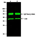 Carbonic Anhydrase VIII Antibody in Immunoprecipitation (IP)