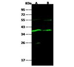 Carbonic Anhydrase VIII Recombinant Rabbit Monoclonal Antibody (005)