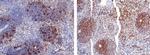 CD2 Antibody in Immunohistochemistry (Paraffin) (IHC (P))