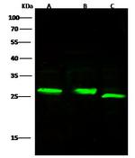 Complement Factor D Recombinant Rabbit Monoclonal Antibody (104)