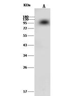 Prothrombin Recombinant Rabbit Monoclonal Antibody (318)