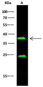 CD16/CD32 Recombinant Rabbit Monoclonal Antibody (015)