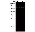 FGFR5 Recombinant Rabbit Monoclonal Antibody (019)