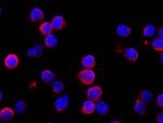 IFNAR1 Recombinant Rabbit Monoclonal Antibody (110)
