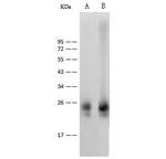 IL36B Recombinant Rabbit Monoclonal Antibody (110)