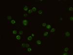IL2RG Recombinant Rabbit Monoclonal Antibody (011)