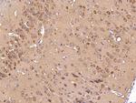 S100A5 Antibody in Immunohistochemistry (Paraffin) (IHC (P))