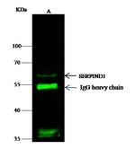 Heparin Cofactor II Antibody in Immunoprecipitation (IP)
