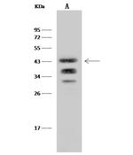 Ly-108 Recombinant Rabbit Monoclonal Antibody (040)