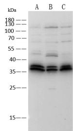TROP2 Recombinant Rabbit Monoclonal Antibody (064)