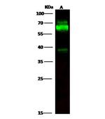 Tyrosine Hydroxylase Recombinant Rabbit Monoclonal Antibody (001)