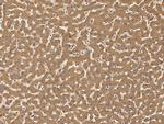 IGFBP2 Antibody in Immunohistochemistry (Paraffin) (IHC (P))
