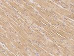 IGFBP2 Monoclonal Antibody (05)