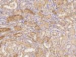 IGFBP2 Antibody in Immunohistochemistry (Paraffin) (IHC (P))