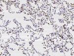 SFTPD Recombinant Rabbit Monoclonal Antibody (001)