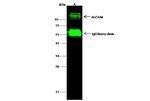 CD166 Antibody in Immunoprecipitation (IP)