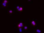 ICAM-1 Antibody in Immunocytochemistry (ICC/IF)