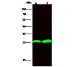 PGP9.5 Recombinant Rabbit Monoclonal Antibody (012)