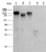 Influenza A H1N1 HA Recombinant Rabbit Monoclonal Antibody (107)