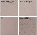 Enterovirus 71 VP1 Antibody in Neutralization (Neu)