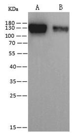 Coronavirus Spike Protein Monoclonal Antibody (07)