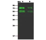 MERS Coronavirus Spike Protein S2 Antibody in Western Blot (WB)