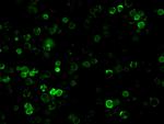 SARS/SARS-CoV-2 Nucleocapsid Recombinant Rabbit Monoclonal Antibody (001)