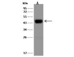 ASGR1 Recombinant Rabbit Monoclonal Antibody (024)
