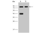 CD44 Recombinant Rabbit Monoclonal Antibody (065)