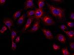 Cathepsin D Recombinant Rabbit Monoclonal Antibody (003)