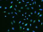 IGFBP7 Recombinant Rabbit Monoclonal Antibody (003)