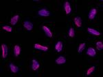 PPIL2 Isoform B Recombinant Rabbit Monoclonal Antibody (015)