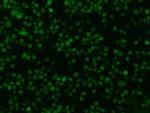 Oncostatin M Recombinant Rabbit Monoclonal Antibody (015)