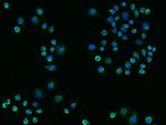 TREM2 Recombinant Rabbit Monoclonal Antibody (014)