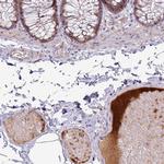 Apolipoprotein L1 Antibody in Immunohistochemistry (Paraffin) (IHC (P))