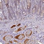 Apolipoprotein L1 Antibody in Immunohistochemistry (Paraffin) (IHC (P))