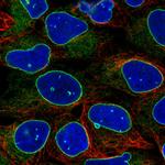 Emerin Antibody in Immunocytochemistry (ICC/IF)