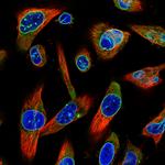 Emerin Antibody in Immunocytochemistry (ICC/IF)